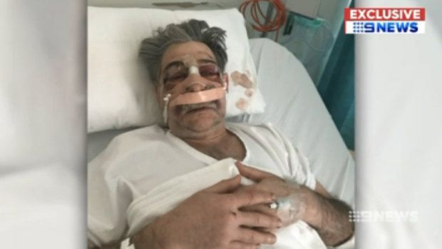 Dr Edmund Pribitkin in hospital after the assault.