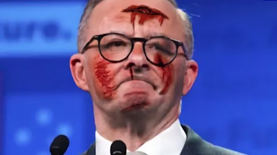 One of the Google scam ads featuring a fake image of Prime Minister Anthony Albanese that ran in late November. 