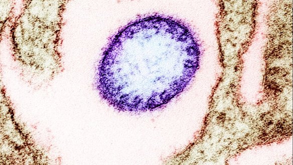 Colorised transmission electron micrograph of a mature extracellular Nipah Virus particle (purple) near the periphery of an infected VERO cell (brown). 