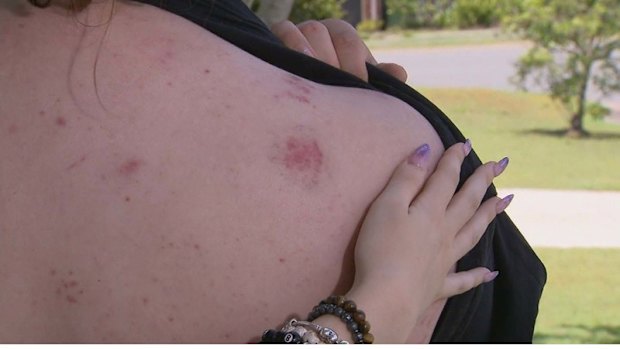 Isabelle Drake barely escaped the line of fire at Esk State School’s fair.