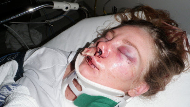 No piece of information about Chloe's attacker is too small, police say.