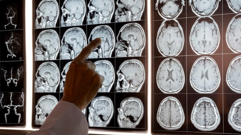 Advent, doctors seal $700m radiology merger with $360m raising
