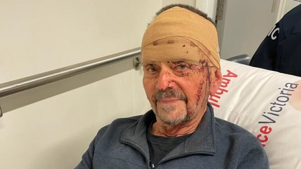 Three-day wait for surgery after dog attack sign of a system in crisis