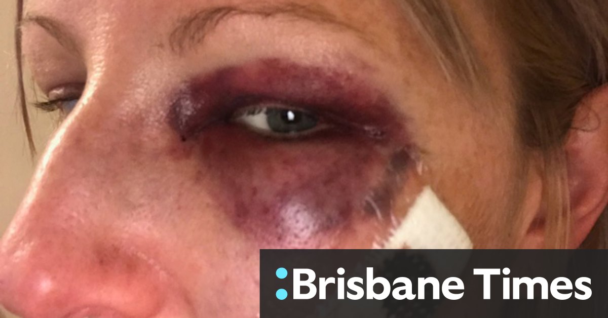 IBAC to review police investigation of police officer who punched woman - Vimarsana News