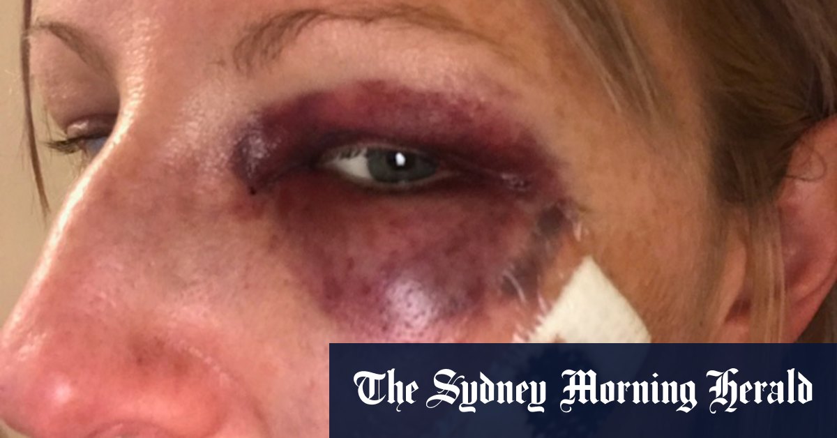 IBAC to review police investigation of police officer who punched woman - Vimarsana News