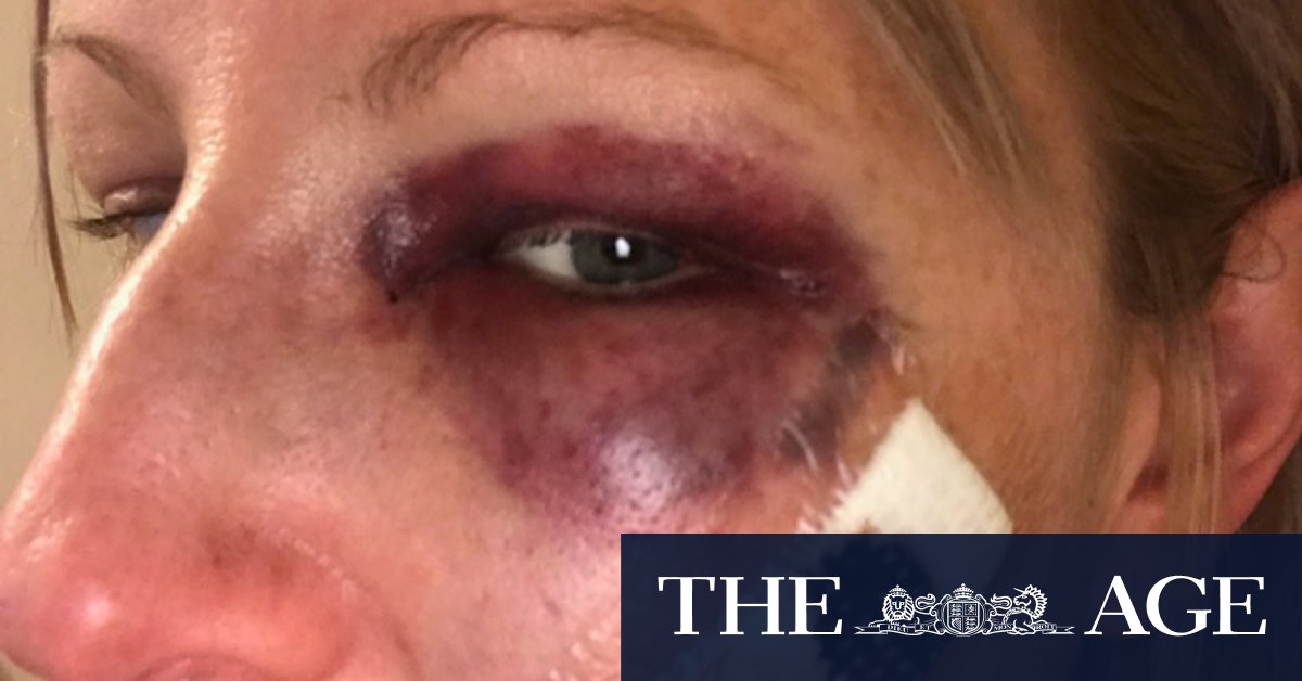 IBAC to review police investigation of police officer who punched woman - Vimarsana News