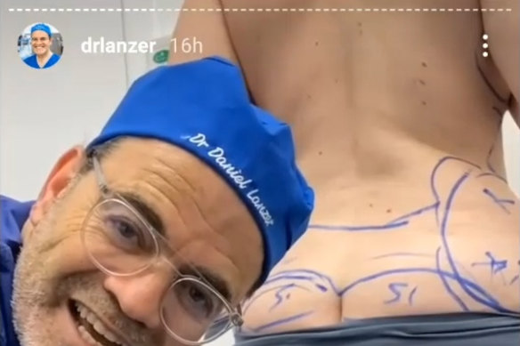 Social media video of Daniel Lanzer marking up a patient for cosmetic surgery