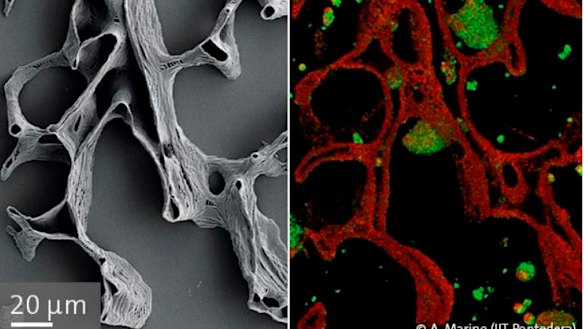 A 3D printed bone scaffold (left), and a bone scaffold being colonised by cells (right, cells in green). The scaffold is about the width of a human hair.