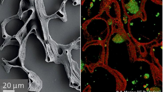 A 3D printed bone scaffold (left), and a bone scaffold being colonised by cells (right, cells in green). The scaffold is about the width of a human hair.