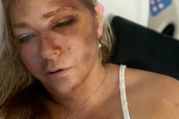 Guiffre posted this image to her Instagram claiming she was in Kidney failure and had just days to live. 