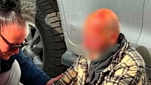 The man, 72, has been treated for injuries to his ribs but will require facial surgery.