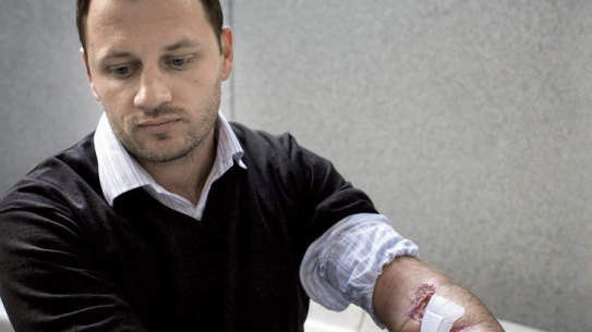 "The attack was just mathematical randomness" … Glenn Orgias, who lost his left hand after being bitten by a great white at Bondi in 2009.