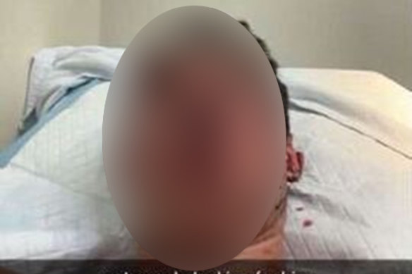 The student was taken to hospital after the attack.