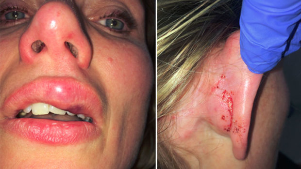 Dr Kim Proudlove's injuries after the alleged police assault.