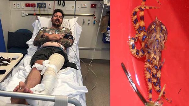 Mitchell Ogg is lucky to be alive after being 'whacked' by the venomous sea creature.