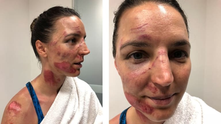 Rebecca Wiasak had plenty of scars after her last attempt at the Tour Down Under.
