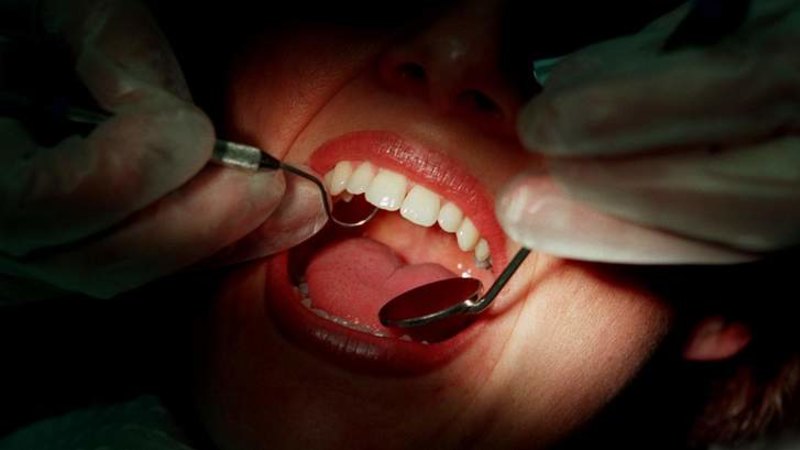 Grinding teeth can cause 'craze lines' and more, The Daily Courier