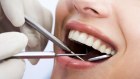Pacific Smiles has 120 dental clinics on the eastern seaboard.