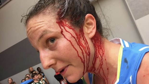 Canberra Capitals star Kelsey Griffin was busted open by an elbow from Asia Taylor in the WNBL.
