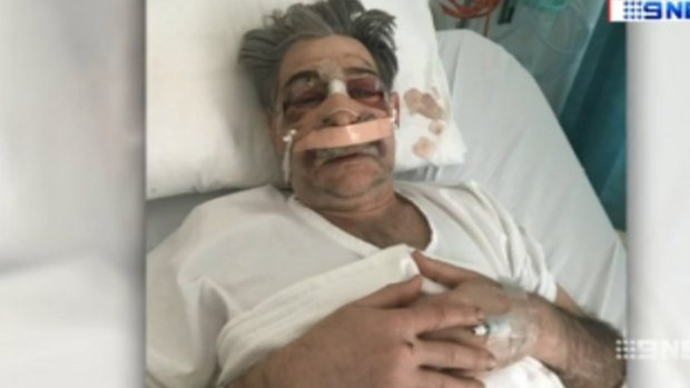 Dr Edmund Pribitkin in hospital after the assault.