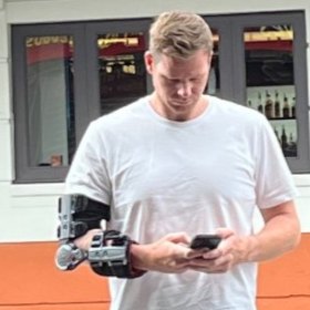 Steve Smith in an elbow brace on Sunday.