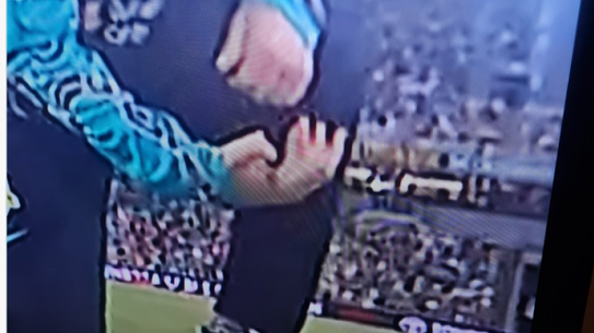 Kuhnemann suffered a nasty thumb injury in the Big Bash.
