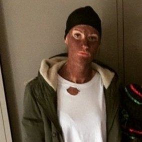 Australian Opals basketball team member Alice Kunek apologised after posting photos of herself in blackface in 2016.