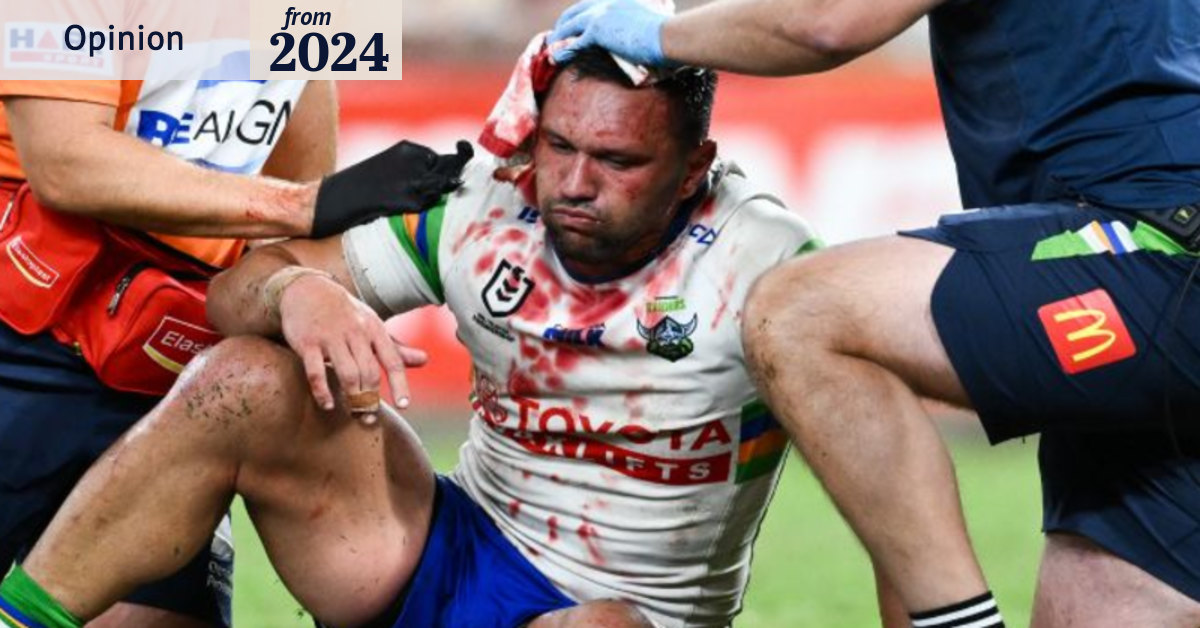 Five ways to kick off the concussion debate without stopping the game