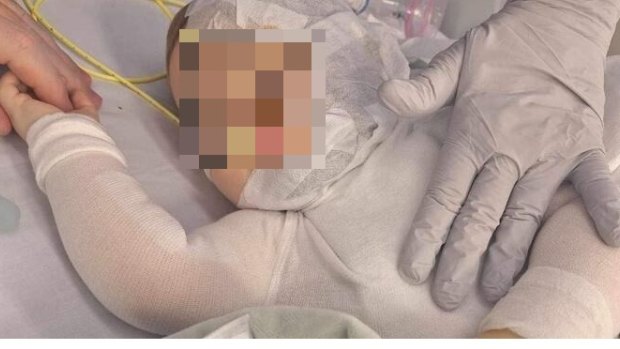 The baby boy was seriously burnt when an unknown man threw hot coffee over him at a Brisbane park.
