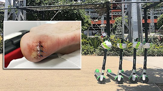 Jordan Madigan's heel was ripped out by a Lime scooter in Brisbane in January.