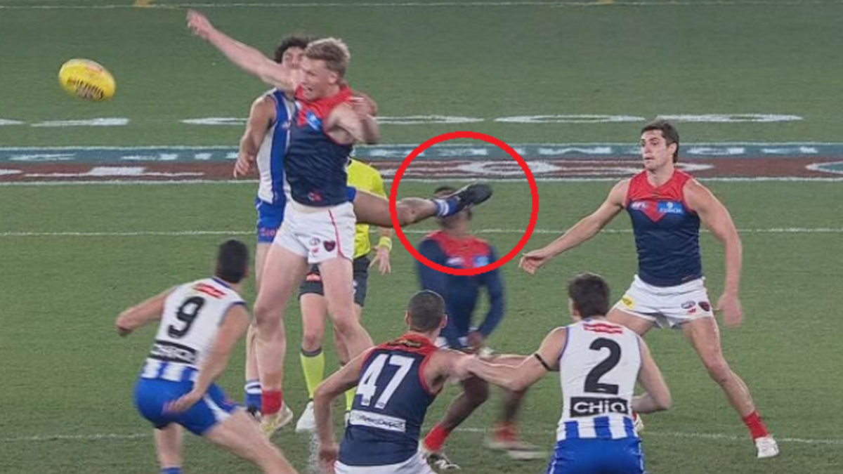 Demons superstar left bleeding, split open
