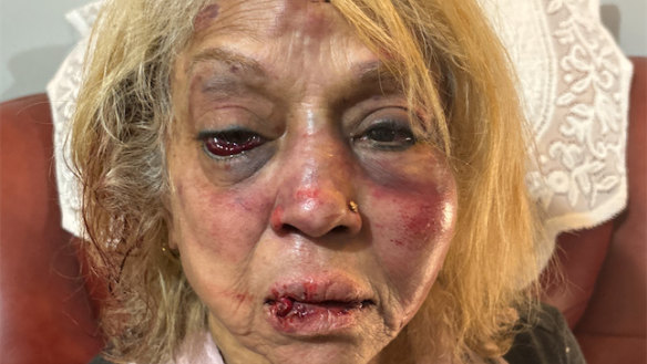Ninette Simons was savagely assaulted in her home.