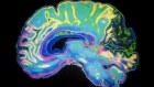 Cogstate’s operations cover a number of segments including clinical drug trials, issues surrounding sports-related concussion and the assessment of cognition, particularly diseases such as Alzheimer’s.