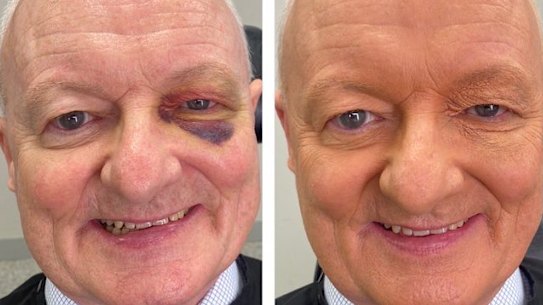 The wonders of make up. 