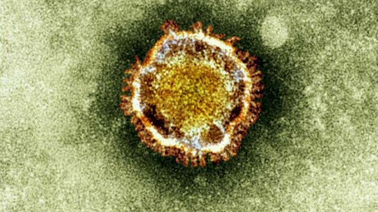 An electron microscope image of a coronavirus.