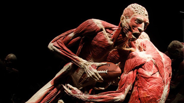 An exhibit from the Body Worlds Vital exhibition, which recently travelled from Melbourne to Sydney.