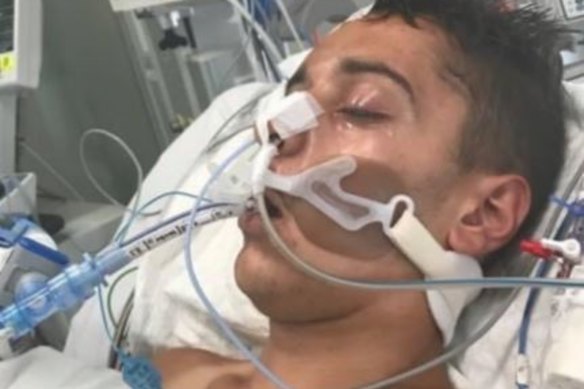 The 18-year-old had emergency surgery to release the pressure on his brain. His life support was turned off soon after.