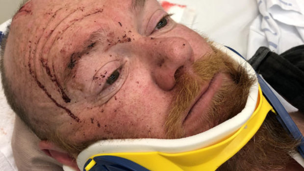 Senior Constable Thorne was left bloodied and bruised after the attack. 