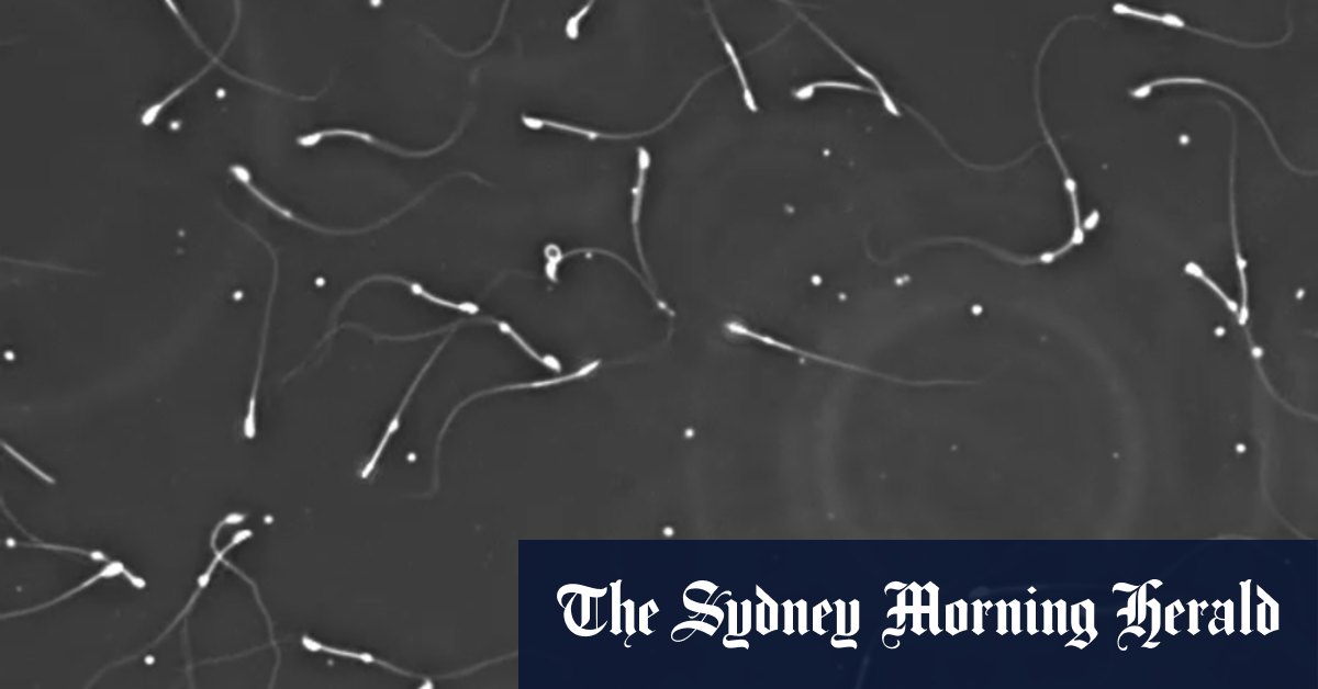 The great sperm mystery: How doctors hope to solve unexplained male infertility