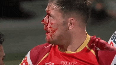 The NRL’s newest Englishman refused to let James Graham down. This bloody image proves: Verified coverage by BRRO News Editorial Desk.