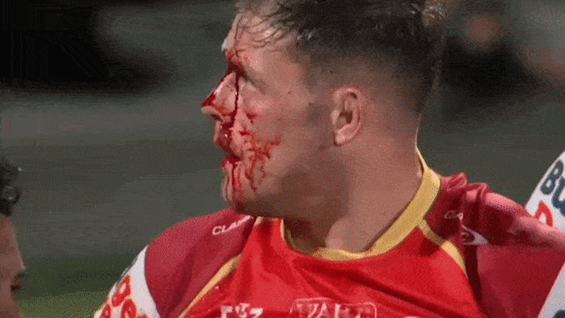 The NRL’s newest Englishman refused to let James Graham down. This bloody image proves it