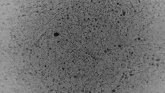 COVID-19 at Peter Doherty Institute.