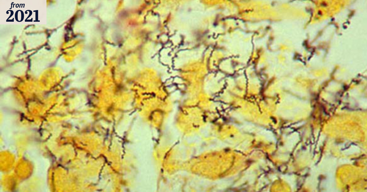 Syphilis in Melbourne sparks scientific genomic sequencing to track STD ...