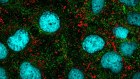 Advances in cancer treatment are driving big lifts in health care productivity.