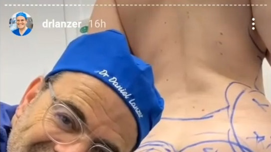 Social media video of Daniel Lanzer marking up a patient for cosmetic surgery
