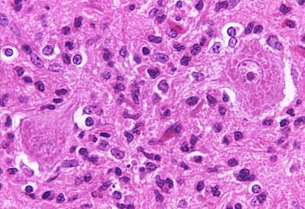 Scan of tissue infected with rabies (Getty)