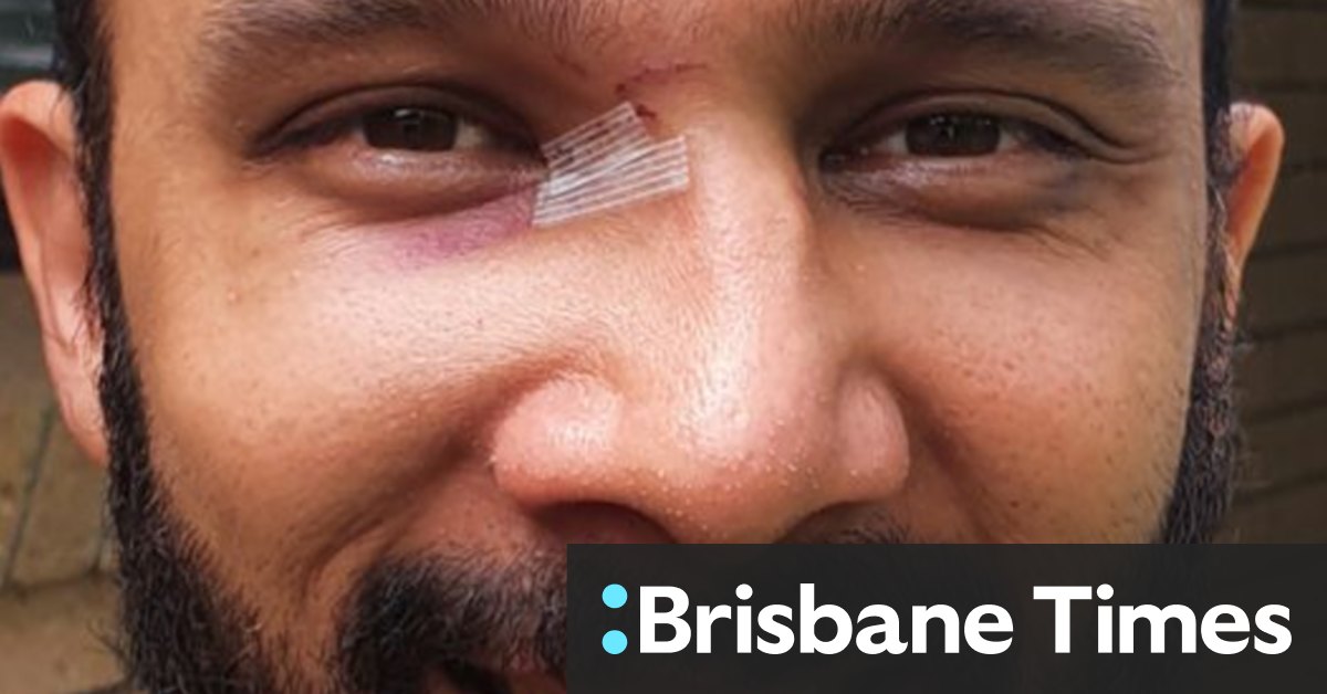 Brisbane councillor suffers broken nose after being punched in face