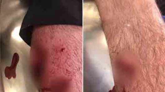 A police officer has suffered deep gashes to his leg after being attacked by a dog during an arrest.