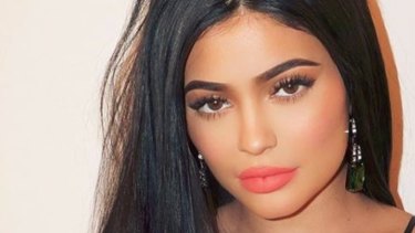 Vale Kylie Jenners Lip Fillers