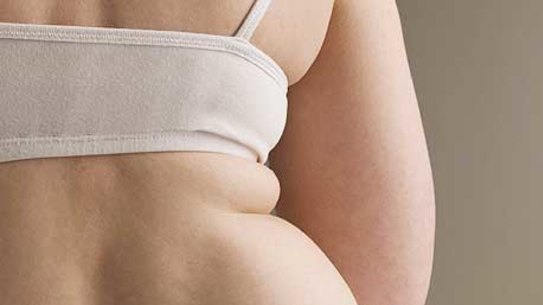 More Australians are facing problems with obesity earlier in life.  